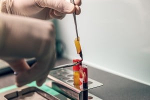 Scientist creating PRF